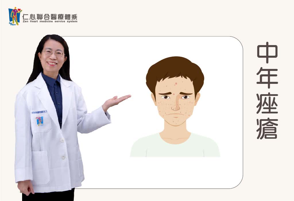 中年痤瘡