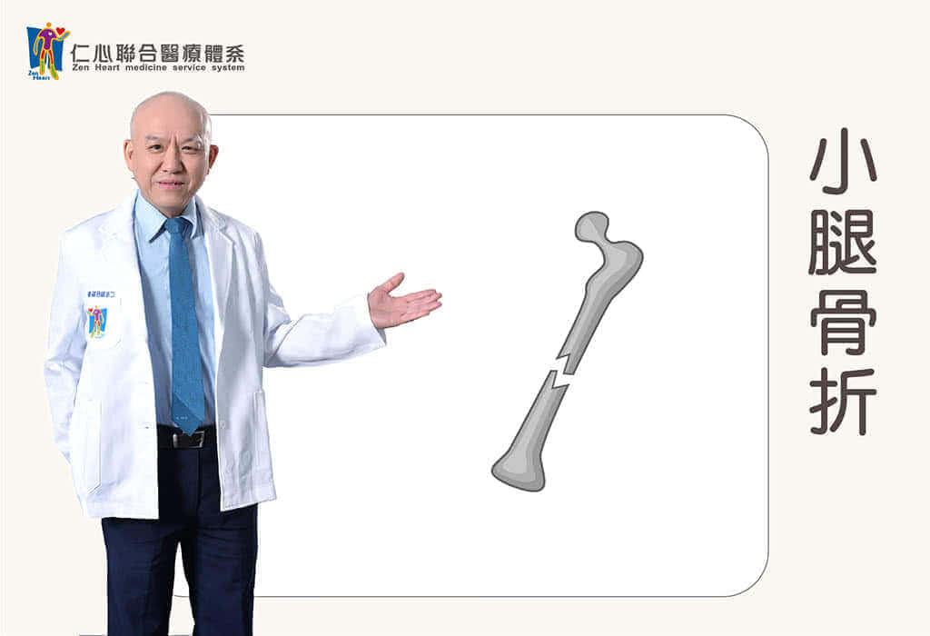 小腿脛腓骨骨幹骨折