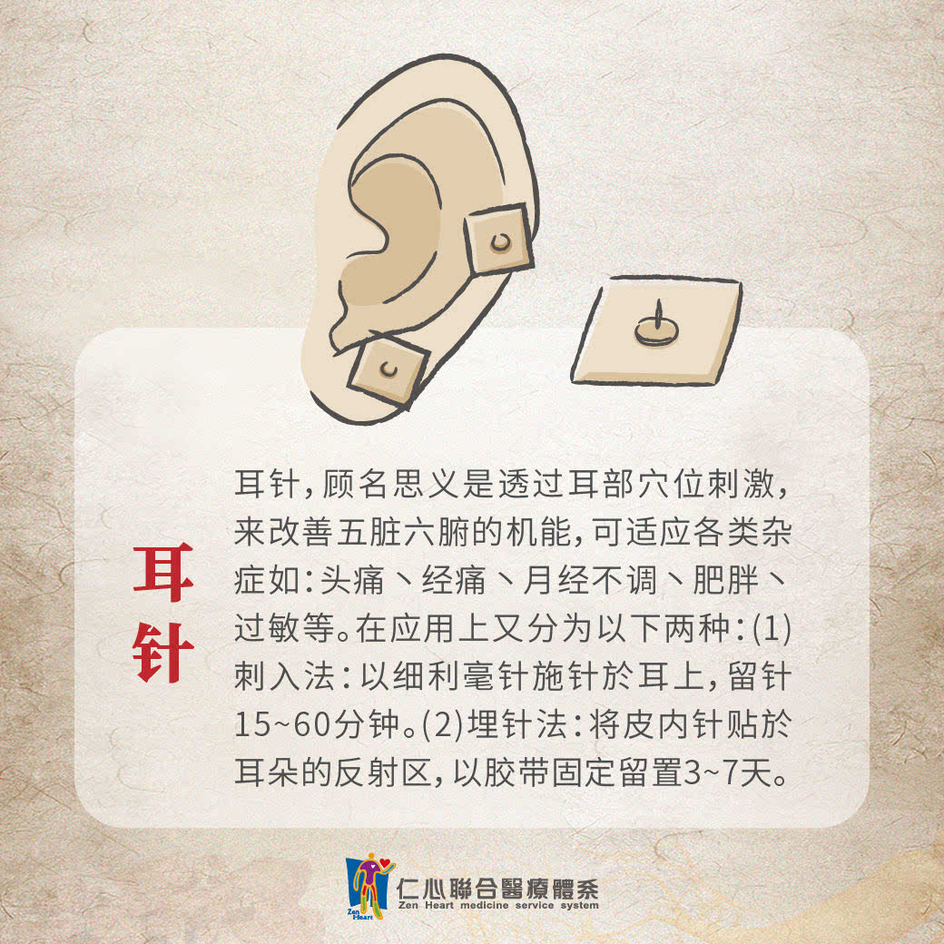 耳针