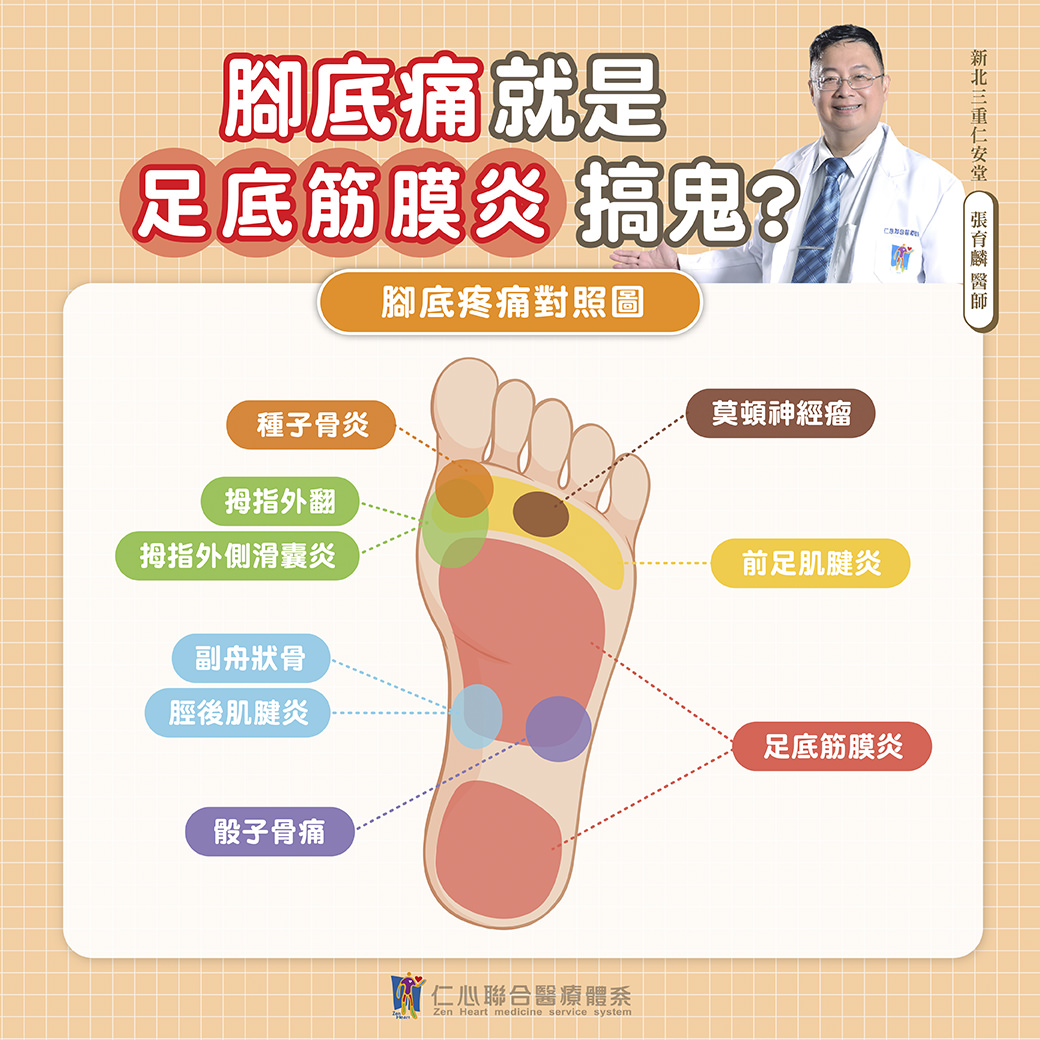 脚底痛是不是足底筋膜炎的征兆？这张图带您了解不同脚底痛的成因，让您快速辨识并及早治疔。从种子骨炎、脚指外翻、到副舟骨和腓骨痛，每一个疼痛点都有可能是不同问题的征兆。特别是当出现足底筋膜炎时，常会让您感到脚底与脚跟的剧烈不适。如果您有类似症状，请别忽视，及时就医诊断是关键！快来了解更多脚底疼痛的解决方法，让您告别不适，重拾轻松行走的日常！
